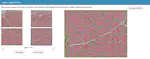 Digital histology for muscle biopsy