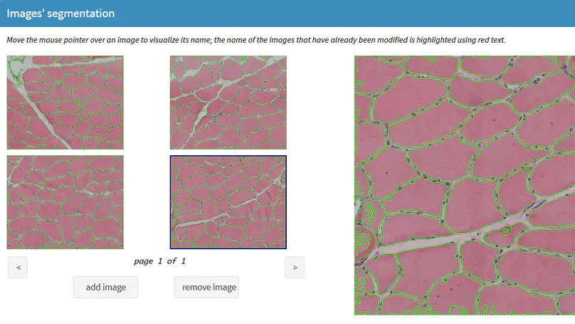 Digital histology for muscle biopsy